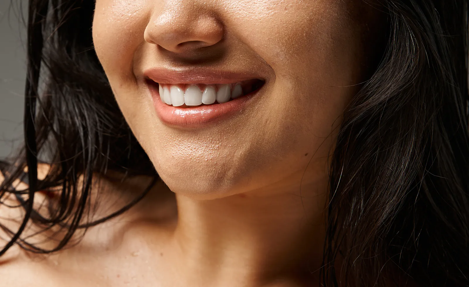 After: clearer, smoother skin on the cheek and jaw